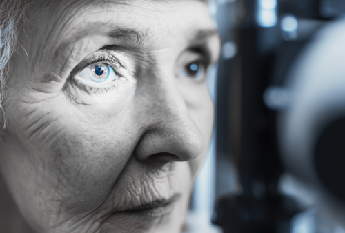 Šedý zákal: Příčiny, rizikové faktory a účinná prevence